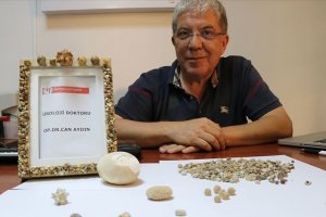Üroloji doktoru hastalarından aldığı 'taşlar'dan koleksiyon yaptı