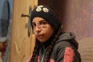 Saldırganlardan zor kurtulan Filistinli küçük kız korku içinde yaşıyor