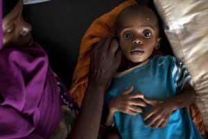 Somali'de kuraklık nedeniyle çocuklar ölüyor