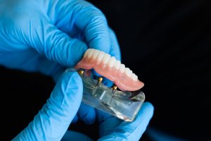 Türkay: Bursa’da firmamız yılda 2 milyon protez diş üretiyor 