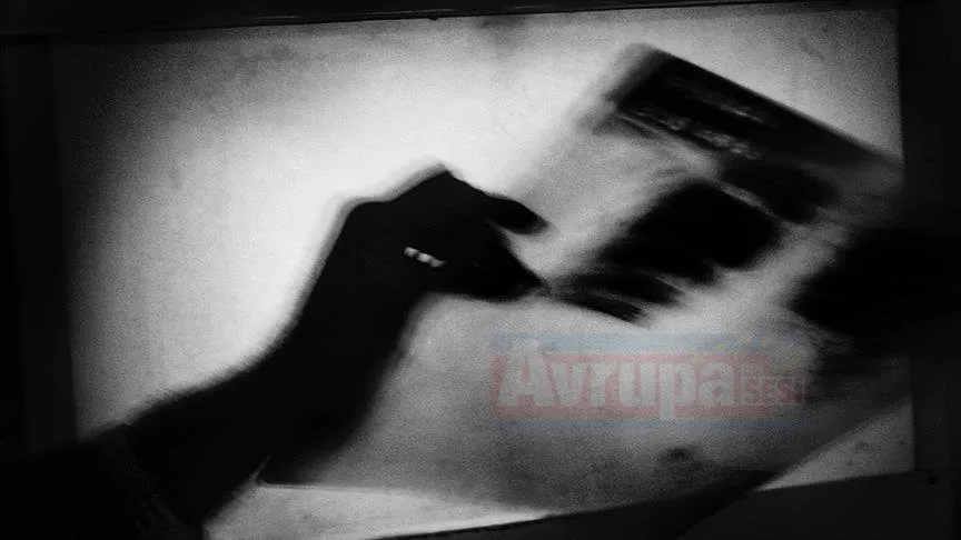 ANKARA   2018 Küresel Verem Raporu'na göre, 2017’de verem hastalığından